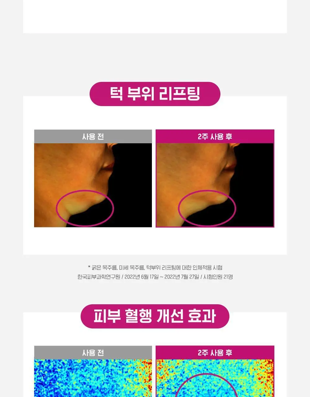 [160만개판매]CKD 레티노콜라겐 저분자 300 괄사 목주름 크림 50ml 1+1 기획 상세페이지 17